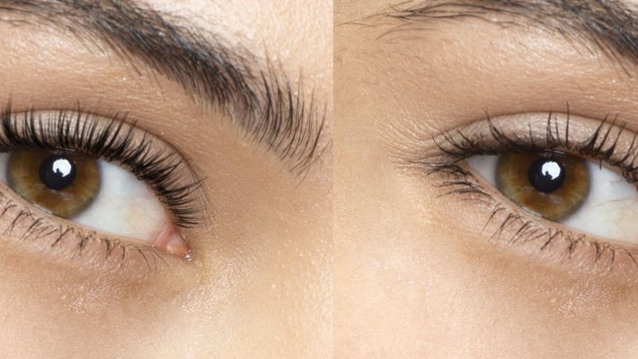 Welches Wimpernliftset ist am besten?